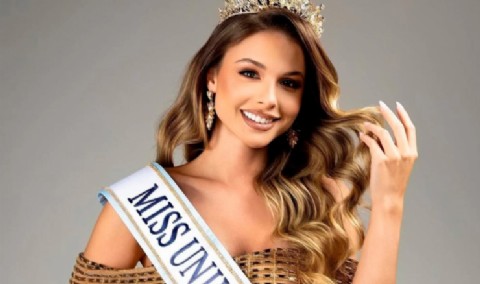 VIDEO | Aldana Masset, Miss Universo Argentina, respondió a las críticas y reveló su alopecia: “Esta soy yo”