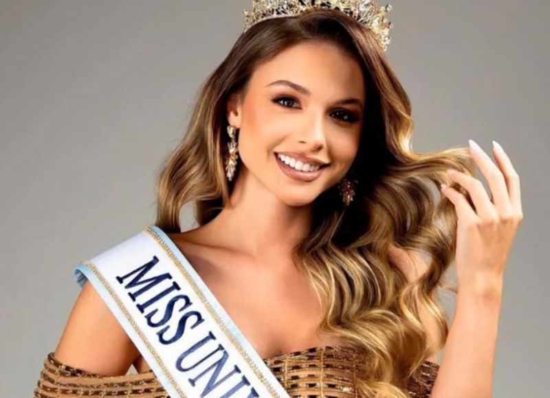 VIDEO | Aldana Masset, Miss Universo Argentina, respondió a las críticas y reveló su alopecia: “Esta soy yo”